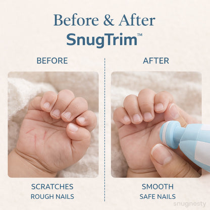 SnugTrim™ Baby Nail Care Kit