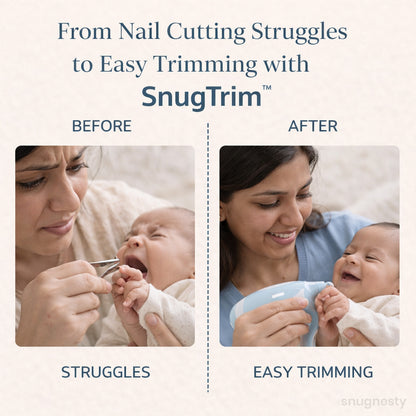 SnugTrim™ Baby Nail Care Kit